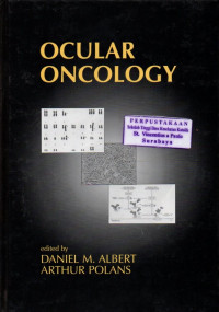 Image of Ocular Oncology